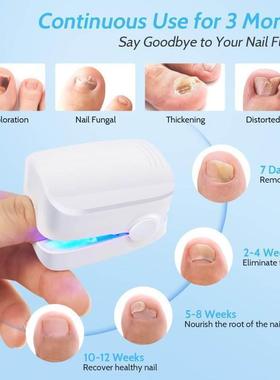 Nail Fungus Laser atment Device For Toenail Fingernail Fungu