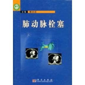 正版 肺动脉栓塞 9787030116567 科学出版社