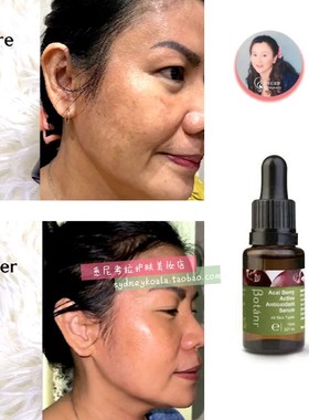 澳洲直邮 Botani Acai Berry巴西莓角鲨烯精华15ml抗氧化之王