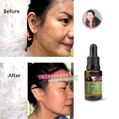 现现 澳洲 Botani Acai Berry巴西莓角鲨烯精华15ml抗氧化之王