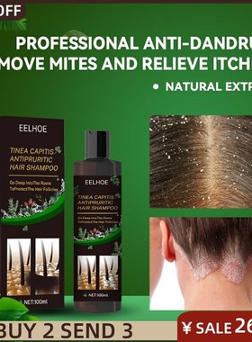 Shampoo Anti-Dandruff Treatment Itching and Flaking Psoriasi