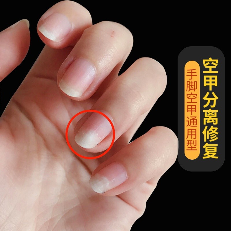 甲肉分离空甲修复指甲生长甲床分离手指甲空分层脚趾甲空壳亮甲油