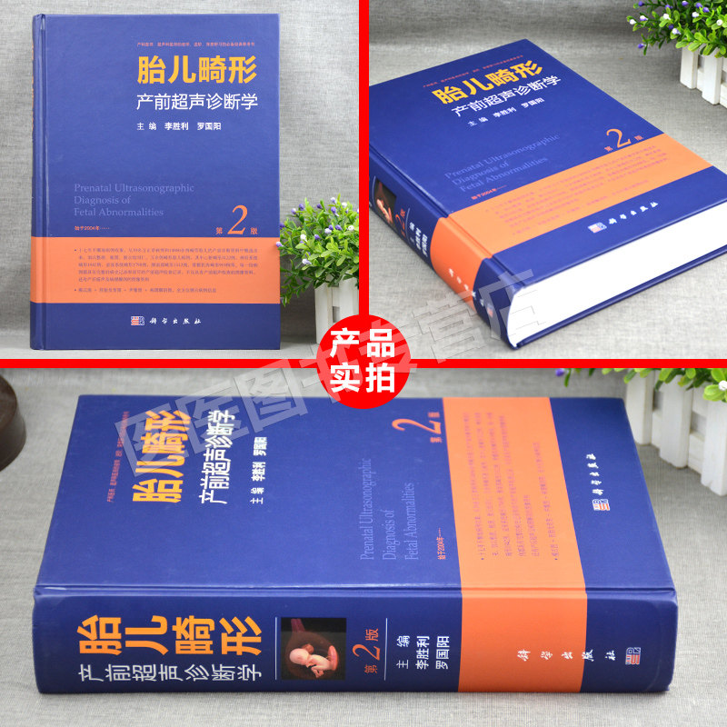 胎儿畸形产前超声诊断学 2二版李胜利影像超声医学书产前超声检查胎儿