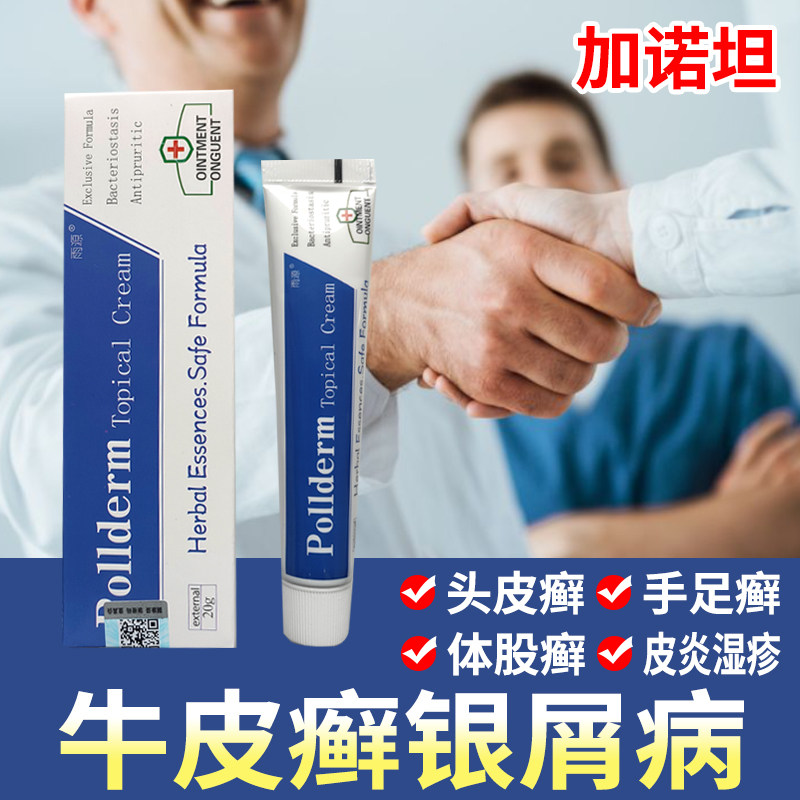 【美国加诺坦】牛皮银屑病无激素手足头皮肤外用牛皮藓全身抑菌