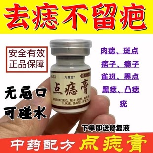 点痣膏无痕点斑去痣水志脸部专用除去黑痣祛膏取药房正品旗舰店wp