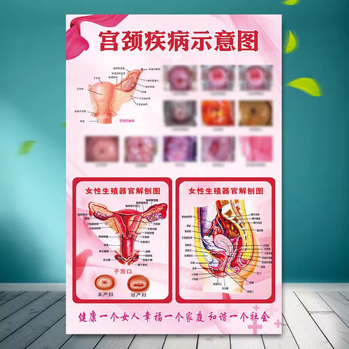 女性泌尿生殖系统宫颈疾病解刨