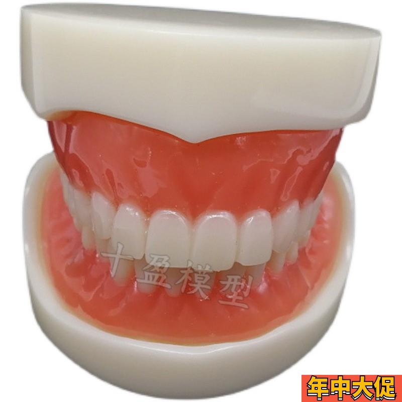 牙科模型 活动义齿牙模讲解模型 全口义齿四颗钉教学模型T21包邮
