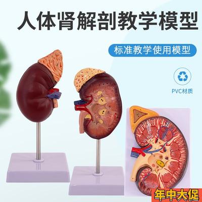 人体肾解剖模型病变肾脏模型 自然大肾脏附肾上腺 放大肾解剖模型
