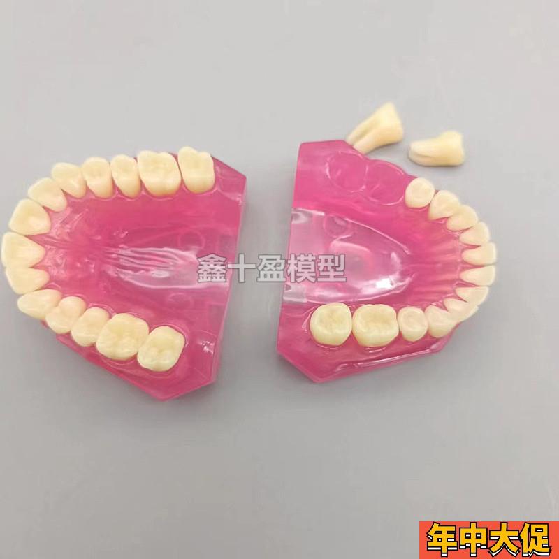 牙科口腔教学生练习拔牙模型全口可拆卸牙齿软牙龈28颗牙齿FE颌架