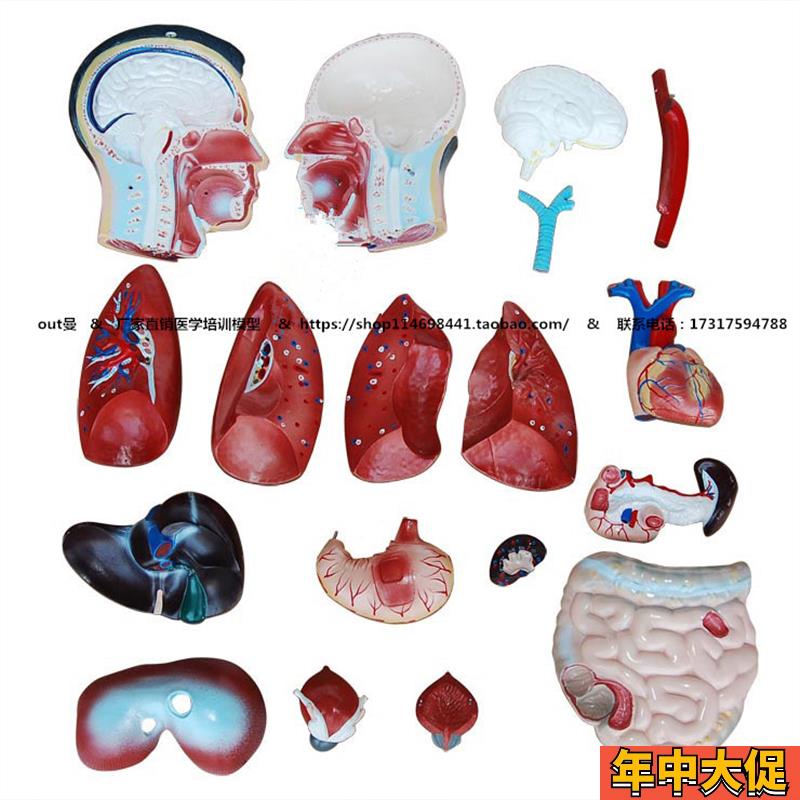 厂家直销正品男性人体半身躯干模型(85cm/19件) 包邮