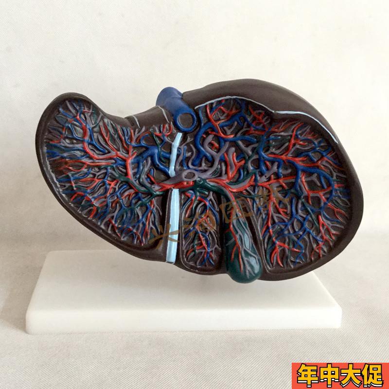 肝解剖模型