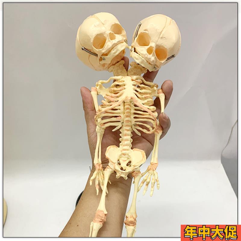人体婴儿骨骼模型 双头胎儿头骨 畸形婴儿人骨架演示教具胎儿头骨