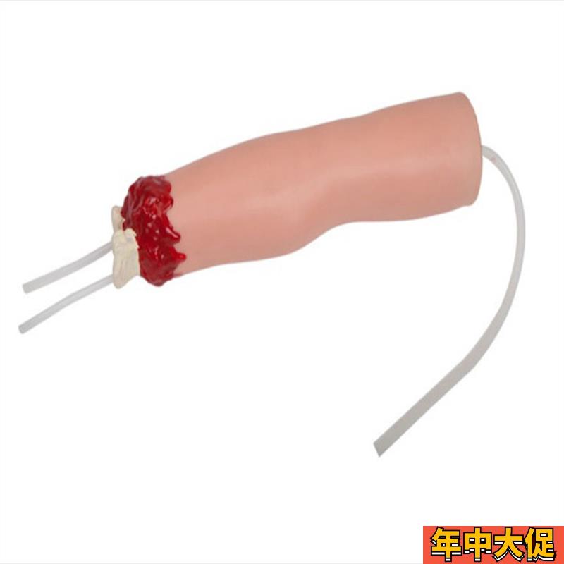 上肢外伤断肢止血模型
