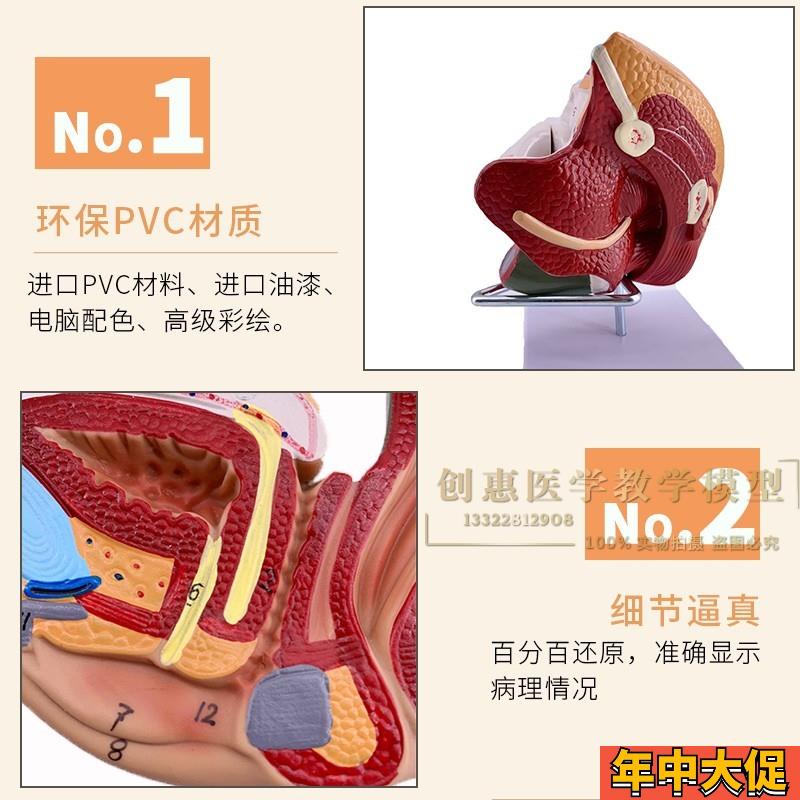 医学人体男性内外生殖气官泌尿系统模型男科解剖结构模具计生健康