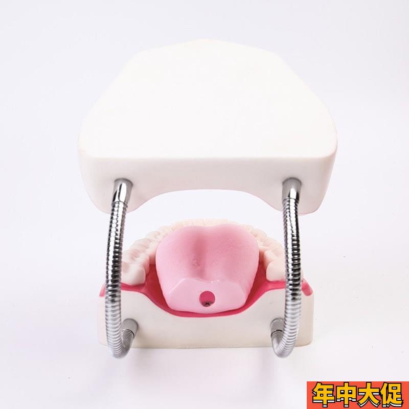 高级牙保健护理模型口腔护理模型放大5倍