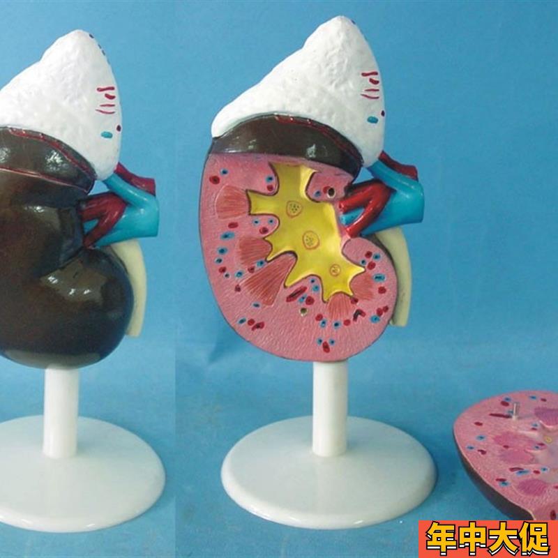 人体肾脏解剖模型 器官解剖 医用教学讲解展示标本