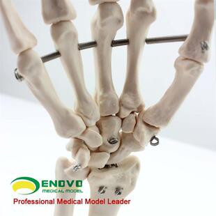 ENOVbO颐诺医学人体手关节模型手骨尺骨桡骨模型人体骨骼手足外科