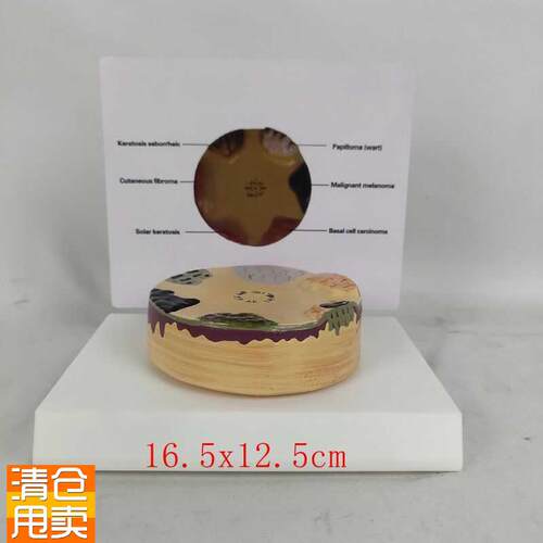人体病理皮肤演示模型表皮皮肤解剖模型O皮肤科教具教学演示