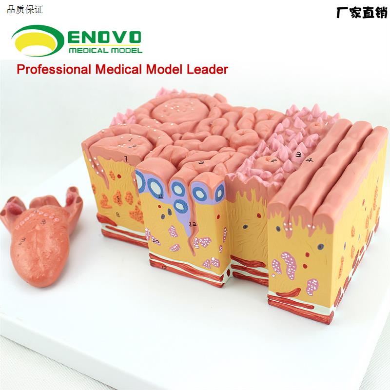 ENOVO颐诺医学W人体舌部解剖模型舌苔舌乳头味蕾口腔消化内科教学