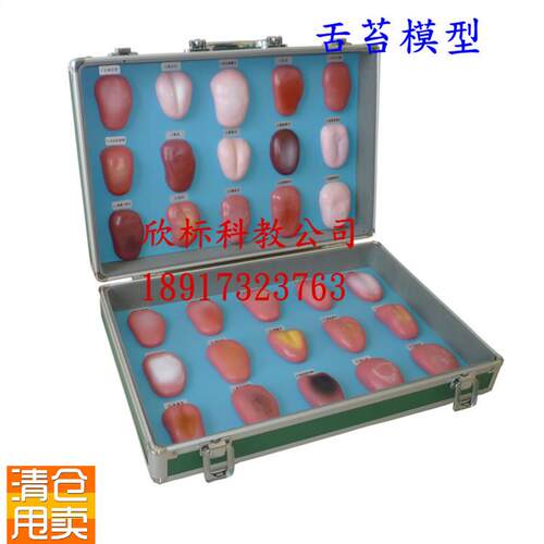 舌苔模型舌像模型30种正常舌苔及D各种疾病在舌苔上的病态变症状