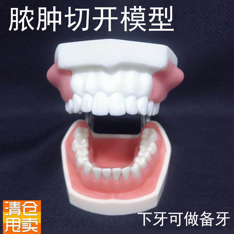 脓肿切开模型口腔执业医师考前培训引H流牙模牙科教学牙齿肿块可