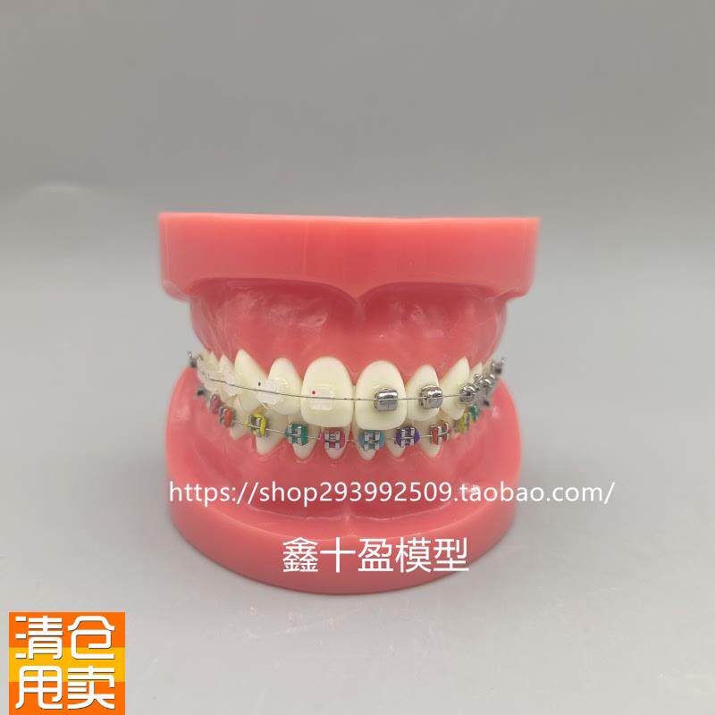 牙科正畸模型球形金属自锁托槽正畸模K型矫正练习模型医患沟通