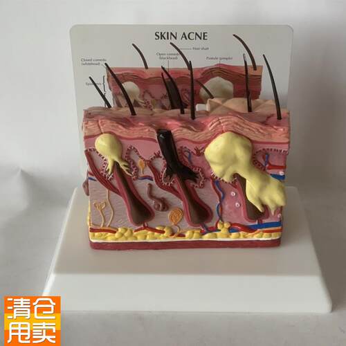 人体皮肤放大皮肤痤m疮毛发生长头发健康皮肤脱发毛囊毛细血管黑