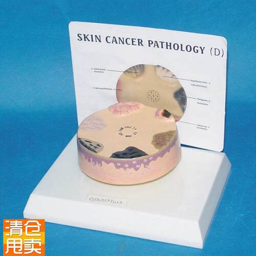 人体皮肤放k大解病理剖模型医用教学模型