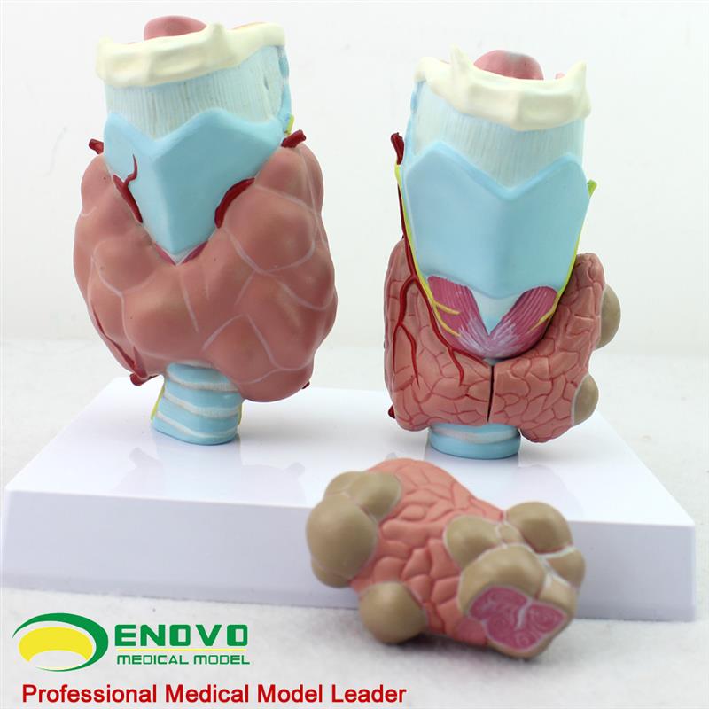 ENOVO正品人体甲状腺病理模型甲F亢甲低甲减内分泌系统医学解剖