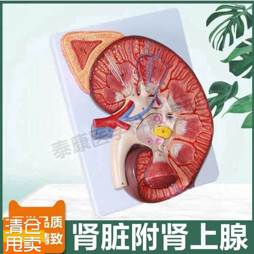 大型肾脏解剖模型肾上腺输尿管肾单位H肾小球病理尿液蛋白尿形成