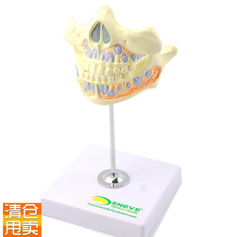 ENOVaO颐诺乳牙牙列模型儿童口腔齿科牙医培训教学医生教具乳牙