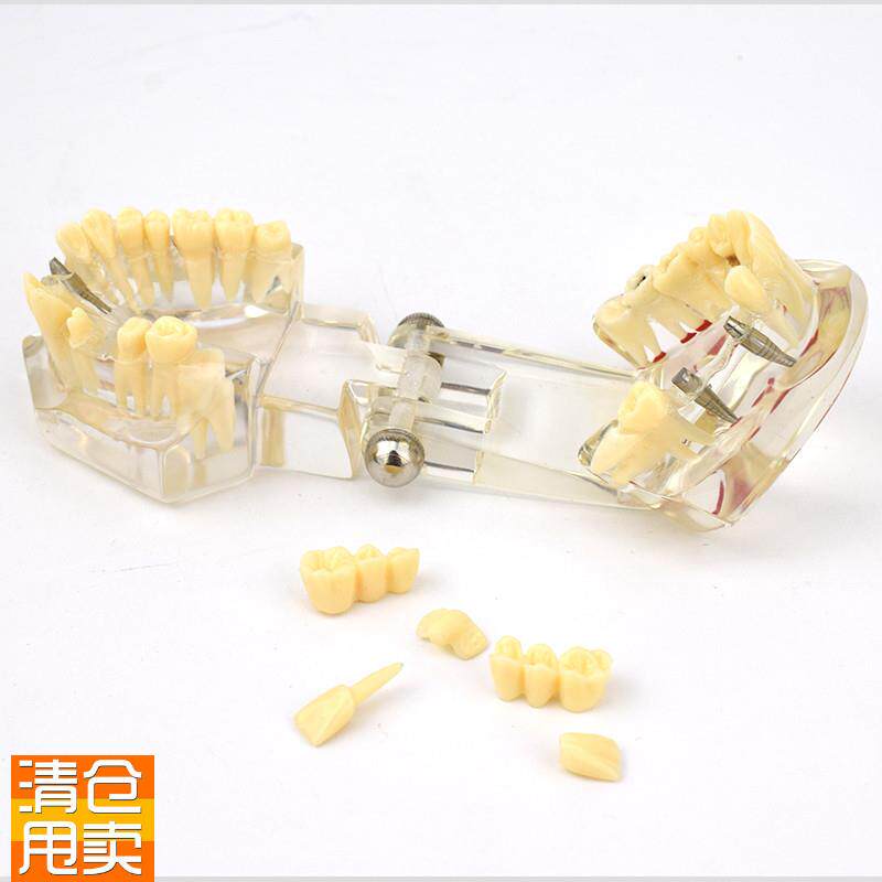 ENOVO颐诺口腔模型齿科修复种植阻生齿牙体牙Z髓口腔教学