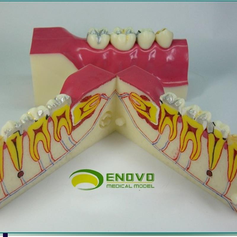 ENOVO颐诺右下后牙组织分解模型牙齿解剖牙列模型W口腔齿科科教学