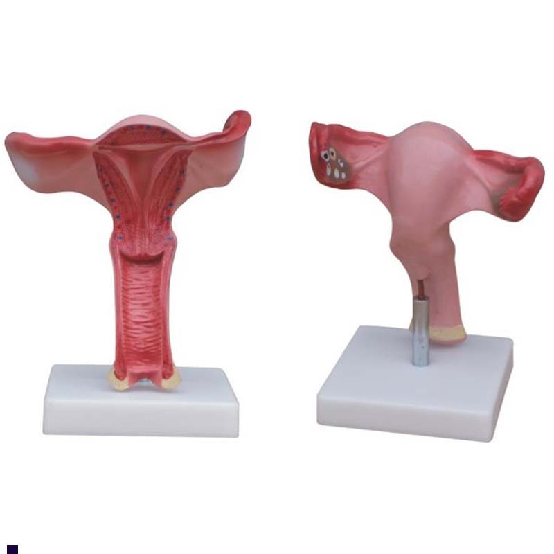 高级子宫放大模型l女性生殖系统解剖模型/人体模型/美院专用