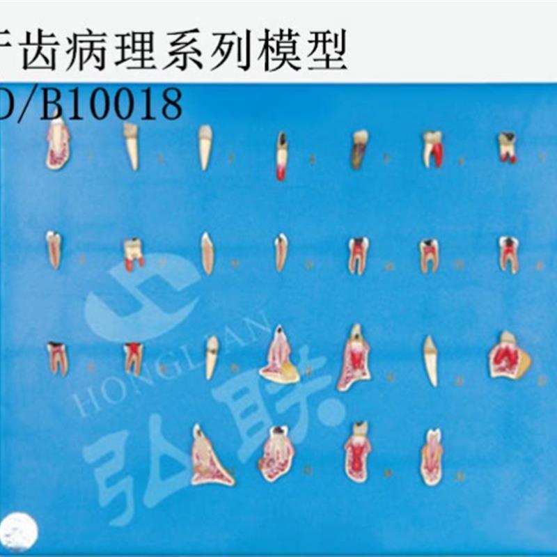 全科医生 GD/B100E18 牙齿病理系列模型