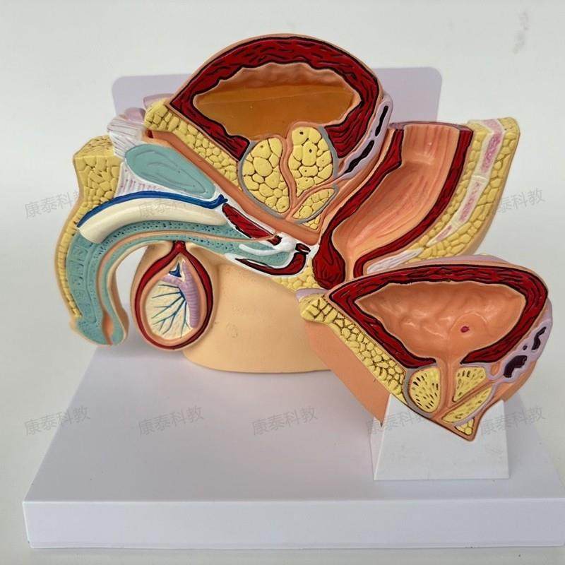 康泰医学教具 男性盆腔膀胱前列腺病理男科医药R促销医患示教生殖