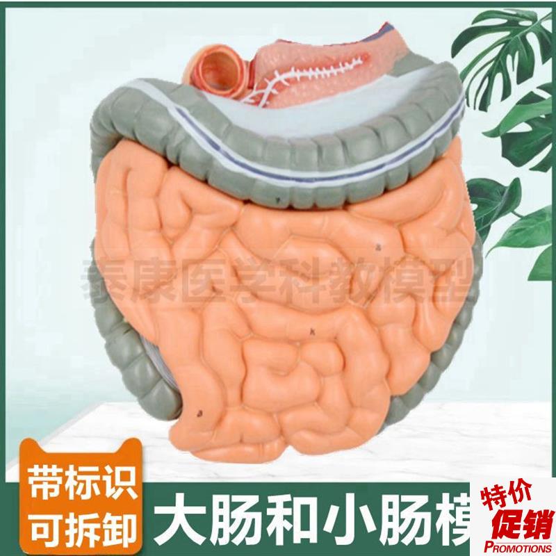 大肠小肠肠系膜肛肠医生用x病理结肠肛周痔疮盲肠阑尾常见病理