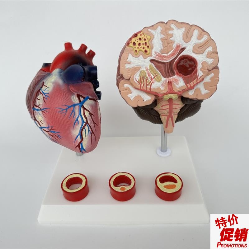心脑血管展示模型血压高心脏模具心血管模M型脑中风脑卒脑解剖教