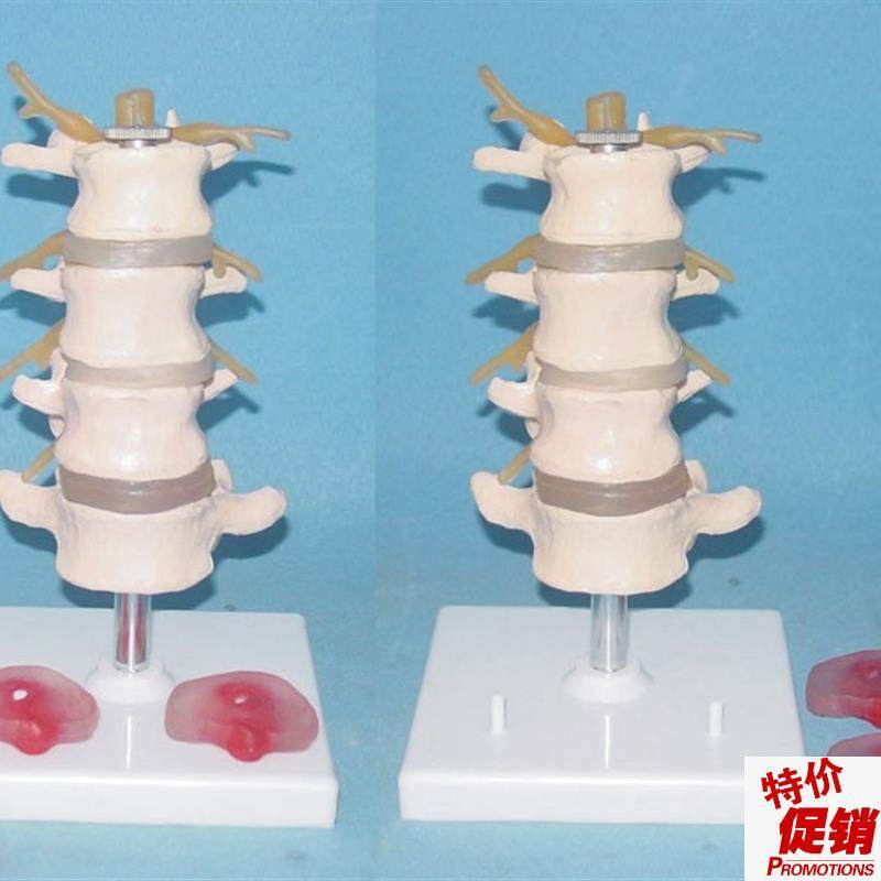 包邮可拆1e:1四节腰椎带2个病变椎间盘突出神经模型骨骼骨架讲解,玩具/童车/益智/积木/模型,其他模型玩具,淘宝优惠券,粉丝福利购,淘宝优惠卷