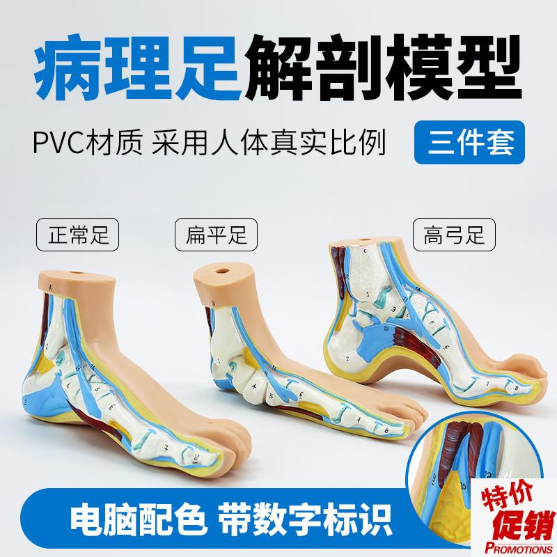 正常足扁平足弓型足模型足部病理模型人体足U部肌肉解剖模型