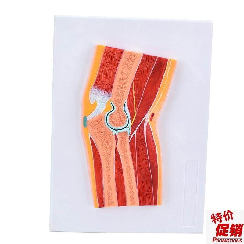 ENOVO颐诺医学解剖肘关节骨骼肌肉模型肘关节剖面肘关节X构造MRI,文具电教/文化用品/商务用品,教学标本/模型,淘宝优惠券,粉丝福利购,淘宝优惠卷