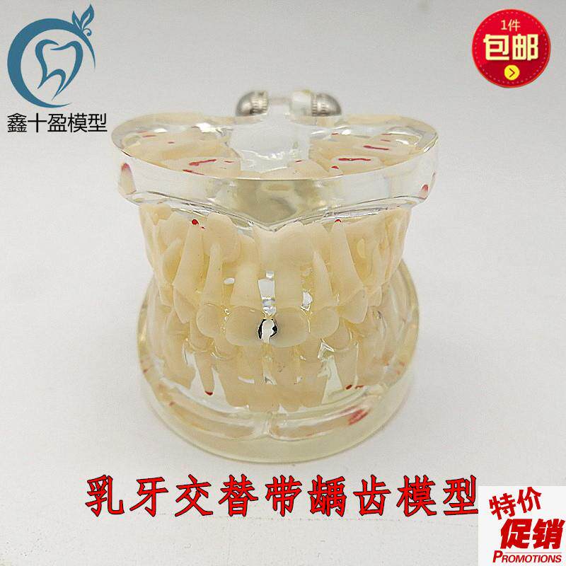 乳牙模型恒牙模型乳牙龋齿牙模型教学窝沟封闭口腔齿X科材料C12