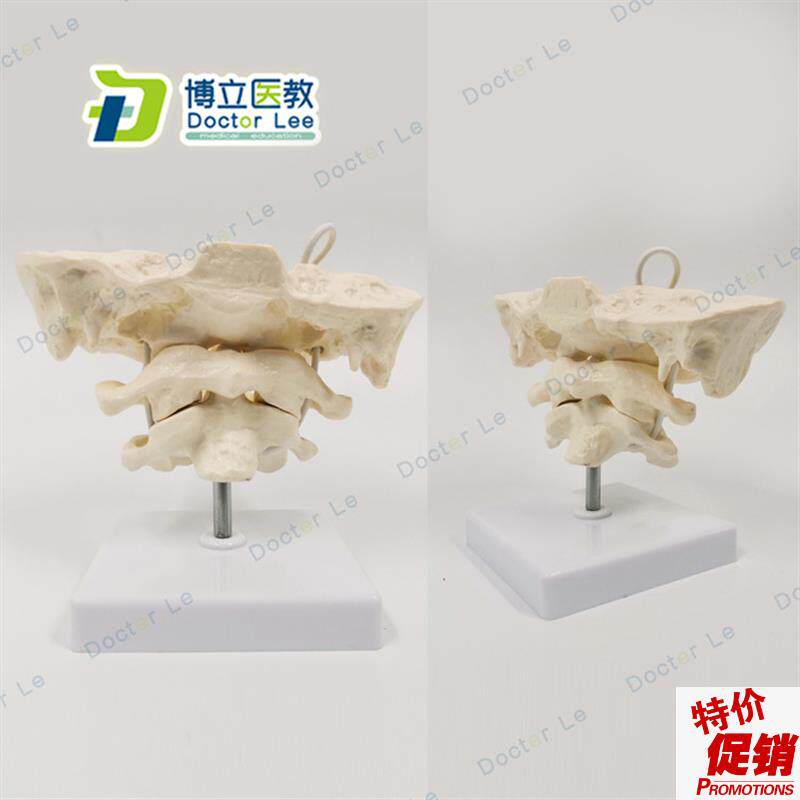 后枕骨颈椎带颈j动脉椎间盘与神经教学模型腰椎骨骼架模型