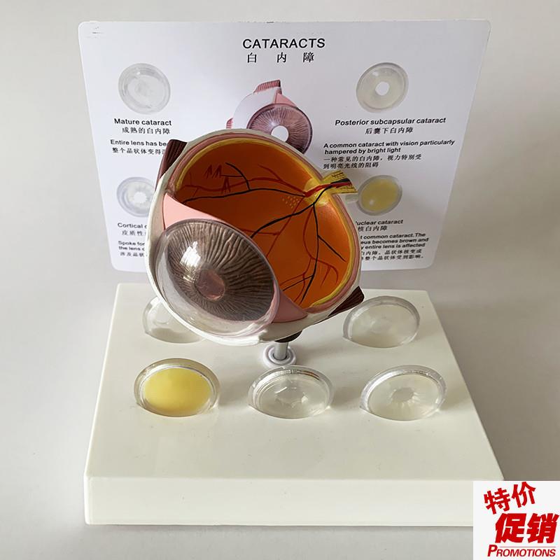 白内障眼睛模型晶片虹膜器官解A剖光学教仪医用医学教学教具包邮