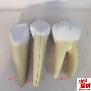 人体牙齿放大解剖l模型牙科牙医教学演示模型牙神经根管治疗讲解