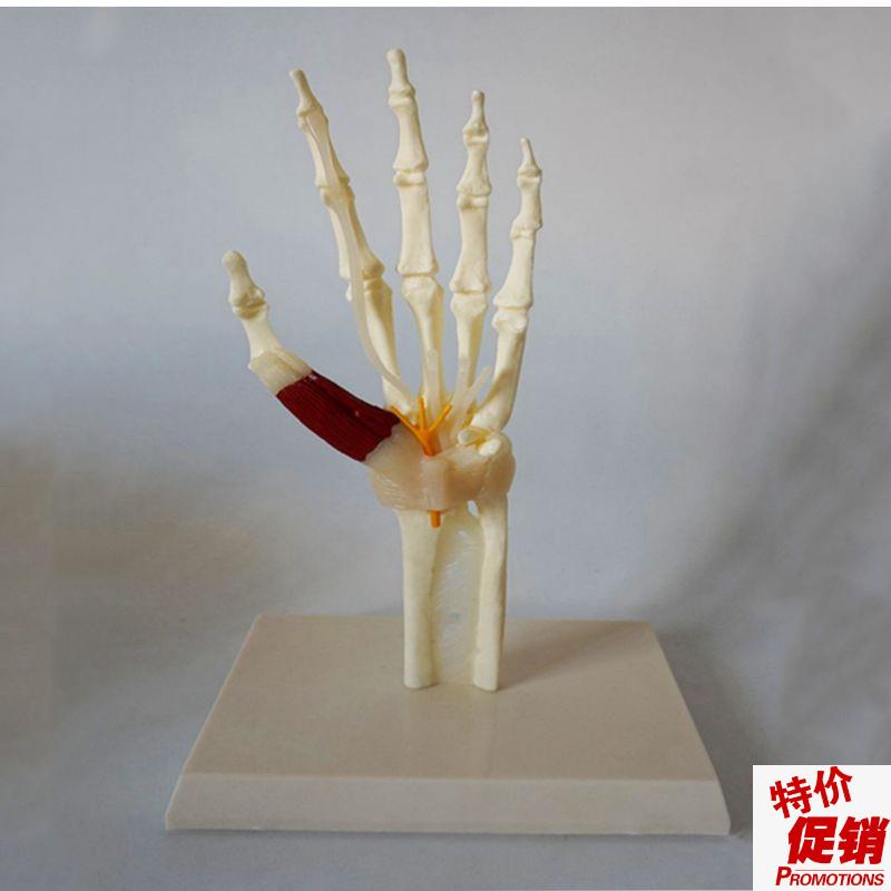 康泰手腕a关节肌腱韧带病理变形痛风类风滑膜关节僵硬肿胀侵蚀性