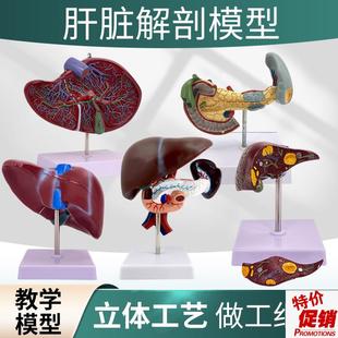 仿真人体肝脏模型肝解剖模型肝胆胰脾十二指肠浮雕U病变肝胆胰模