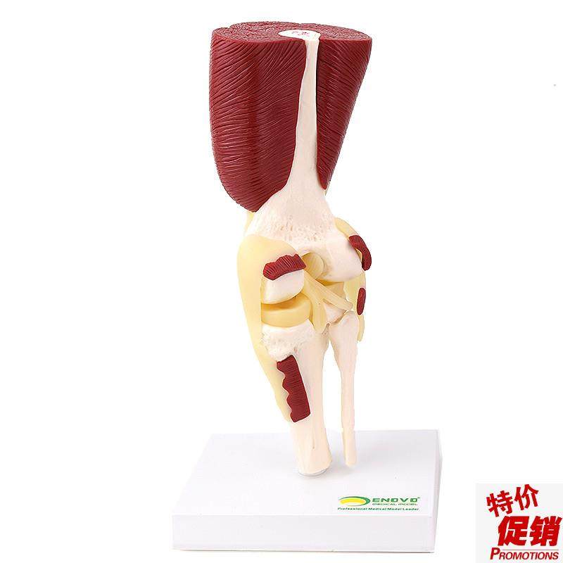 ENOVO颐诺人体膝关节肌肉群模型膝关J节模型滑车关节半月板交叉,文具电教/文化用品/商务用品,教学标本/模型,淘宝优惠券,粉丝福利购,淘宝优惠卷