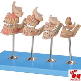 牙与颌骨的发f育模型B10006