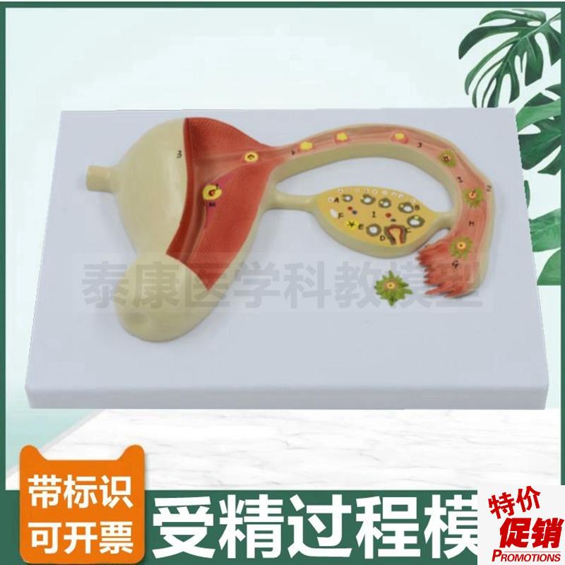 受精过程模型精子和卵子结合生殖胚胎妊娠发育R过程妇产科教学用